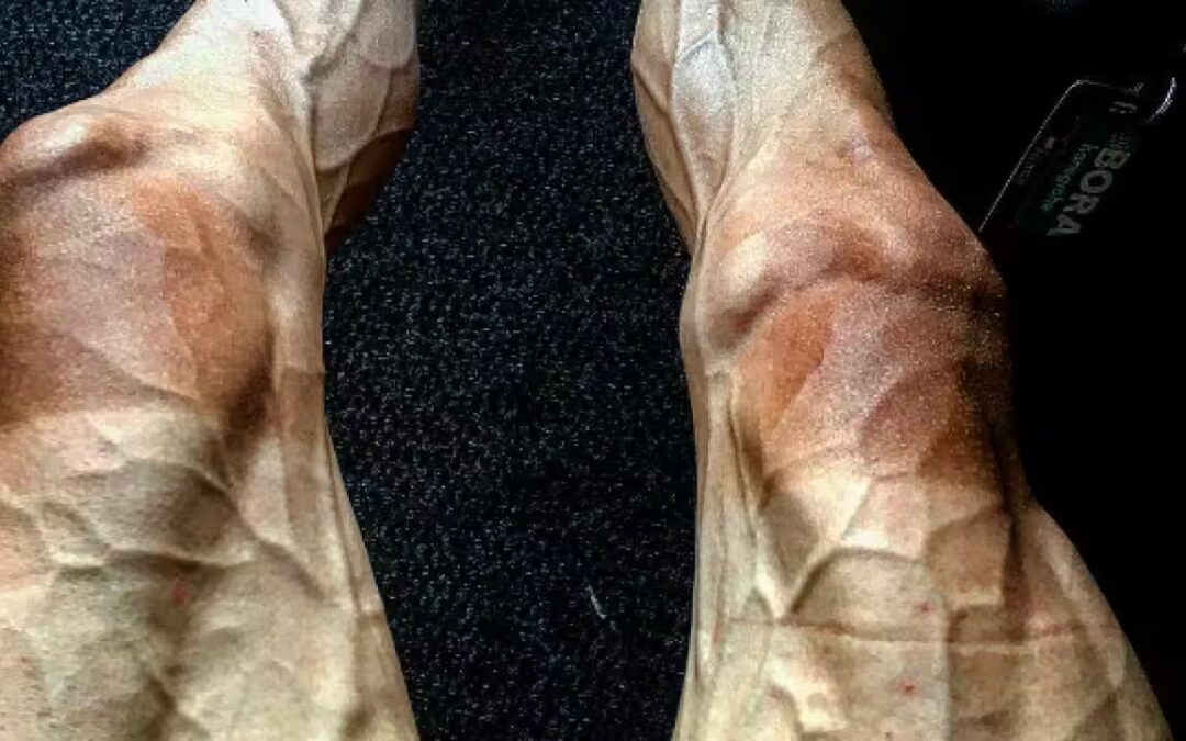 O Sopro das Pequenas Correntes: Ensaios sobre a Vida na Microcirculação Humana